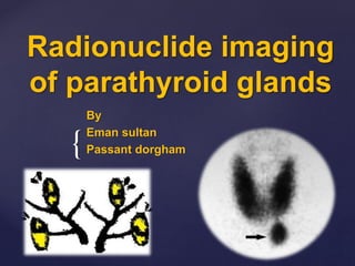 {
Radionuclide imaging
of parathyroid glands
By
Eman sultan
Passant dorgham
 