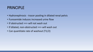 PRINCIPLE
• Hydronephrosis - tracer pooling in dilated renal pelvis
• Furesemide induces increased urine flow
• If obstructed >>> will not wash out
• If dilated, non-obstructed >>> will wash out
• Can quantitate rate of washout (T1/2)
 