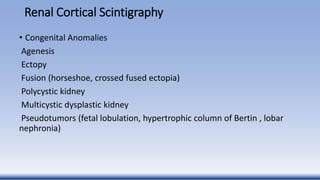 Renal Cortical Scintigraphy
• Congenital Anomalies
Agenesis
Ectopy
Fusion (horseshoe, crossed fused ectopia)
Polycystic kidney
Multicystic dysplastic kidney
Pseudotumors (fetal lobulation, hypertrophic column of Bertin , lobar
nephronia)
 