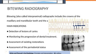 Seminar on radiographs in prosthodontics | PPTX