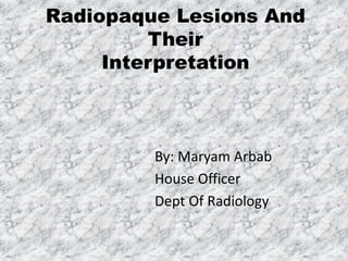 Radiopaque Lesions And
Their
Interpretation
By: Maryam Arbab
House Officer
Dept Of Radiology
 