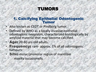 Radiopaque Lesions | PPTX