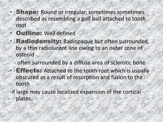 Radiopaque Lesions