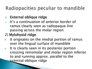 Region Parallel Ridges Radiopacities of jaws | PPTX