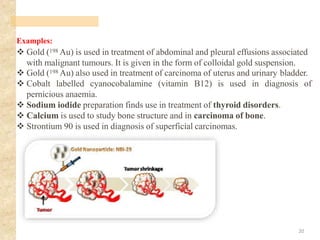 Examples:
❖ Gold (198 Au) is used in treatment of abdominal and pleural effusions associated
with malignant tumours. It is given in the form of colloidal gold suspension.
❖ Gold (198 Au) also used in treatment of carcinoma of uterus and urinary bladder.
❖ Cobalt labelled cyanocobalamine (vitamin B12) is used in diagnosis of
pernicious anaemia.
❖ Sodium iodide preparation finds use in treatment of thyroid disorders.
❖ Calcium is used to study bone structure and in carcinoma of bone.
❖ Strontium 90 is used in diagnosis of superficial carcinomas.
20
 