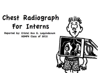 Chest Radiograph ,[object Object],For Interns ,[object Object],Reported by: Cristal Ann G. Laquindanum,[object Object],		     ASMPH Class of 2012,[object Object]