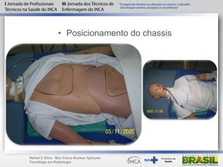 • Posicionamento do chassis
Rafael C Silva - Msc Física Nuclear Aplicada
Tecnólogo em Radiologia
 