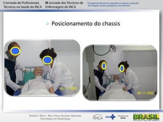  Posicionamento do chassis
Rafael C Silva - Msc Física Nuclear Aplicada
Tecnólogo em Radiologia
 