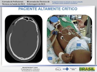PACIENTE ALTAMENTE CRÍTICO
Marcelo Henrique F. Lemos
TR.Radiodiagnóstico e Enfermeiro
Pós-Graduando em intensivismo
 