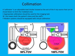 Radioprotection in Angiography | PDF