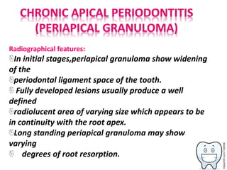 Radiographical features:
In initial stages,periapical granuloma show widening
of the
periodontal ligament space of the tooth.
Fully developed lesions usually produce a well
defined
radiolucent area of varying size which appears to be
in continuity with the root apex.
Long standing periapical granuloma may show
varying
degrees of root resorption.
 