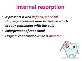 • It presents a well defined,spherical
shaped,radiolucent area in dentine which
usually continuous with the pulp
• Enlargement of root canal
• Original root canal outline is distored
 