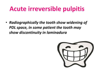 • Radiographically the tooth show widening of
PDL space, in some patient the tooth may
show discontinuity in laminadura
 