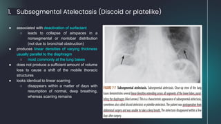 1. Subsegmental Atelectasis (Discoid or platelike)
● associated with deactivation of surfactant
○ leads to collapse of airspaces in a
nonsegmental or nonlobar distribution
(not due to bronchial obstruction)
● produces linear densities of varying thickness
usually parallel to the diaphragm
○ most commonly at the lung bases
● does not produce a sufficient amount of volume
loss to cause a shift of the mobile thoracic
structures
● looks identical to linear scarring
○ disappears within a matter of days with
resumption of normal, deep breathing,
whereas scarring remains
 