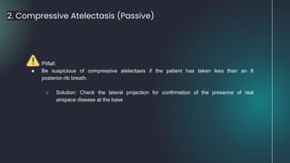 2. Compressive Atelectasis (Passive)
● Pitfall:
● Be suspicious of compressive atelectasis if the patient has taken less than an 8
posterior-rib breath.
○ Solution: Check the lateral projection for confirmation of the presence of real
airspace disease at the base
 