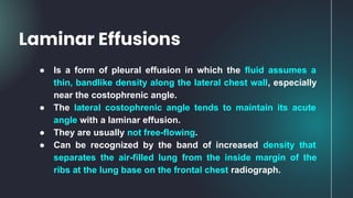 ● Is a form of pleural effusion in which the fluid assumes a
thin, bandlike density along the lateral chest wall, especially
near the costophrenic angle.
● The lateral costophrenic angle tends to maintain its acute
angle with a laminar effusion.
● They are usually not free-flowing.
● Can be recognized by the band of increased density that
separates the air-filled lung from the inside margin of the
ribs at the lung base on the frontal chest radiograph.
Laminar Effusions
 