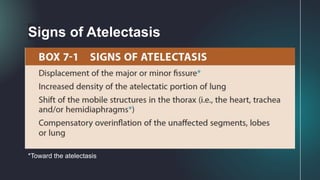 Signs of Atelectasis
*Toward the atelectasis
 