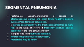 ● Prototypical Bronchopneumonia is caused by
Staphylococcus aureus and other Gram Negative Bacteria
such as Pseudomonas aeruginosa.
● Is spread centrifugally via the tracheobronchial tree to many
foci in the lung. Therefore, it frequently involves several
segments of the lung simultaenously.
● Margins tend to be fluffy and indistinct.
● Airbronchograms usually not present.
● Atelectasis may be noted.
SEGMENTAL PNEUMONIA
 