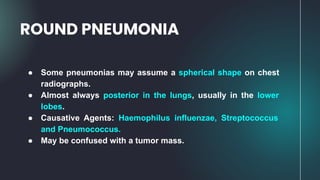 ● Some pneumonias may assume a spherical shape on chest
radiographs.
● Almost always posterior in the lungs, usually in the lower
lobes.
● Causative Agents: Haemophilus influenzae, Streptococcus
and Pneumococcus.
● May be confused with a tumor mass.
ROUND PNEUMONIA
 