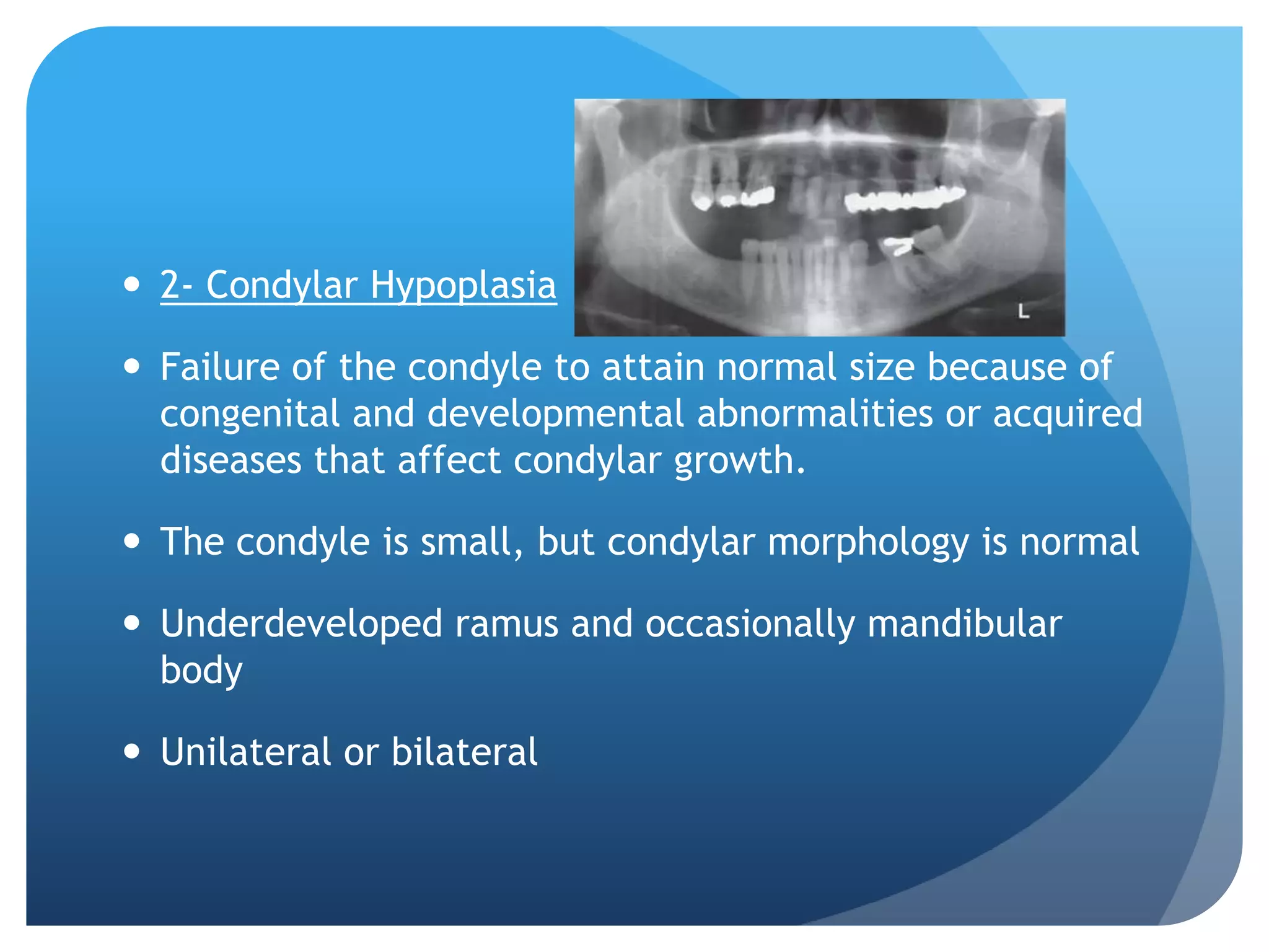  2- Condylar Hypoplasia

 Failure of the condyle to attain normal size because of
  congenital and developmental abnormalities or acquired
  diseases that affect condylar growth.

 The condyle is small, but condylar morphology is normal

 Underdeveloped ramus and occasionally mandibular
  body

 Unilateral or bilateral
 