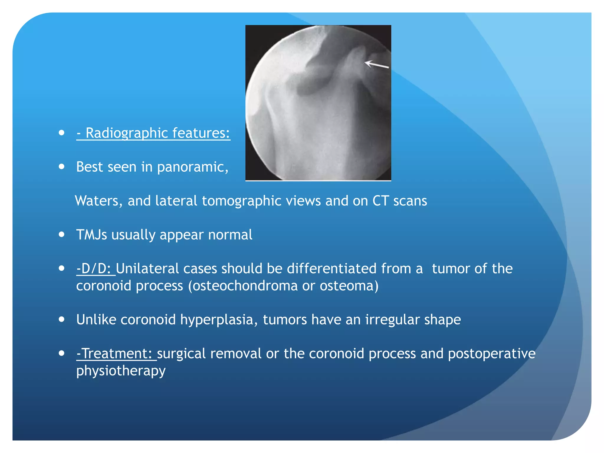  - Radiographic features:

 Best seen in panoramic,

  Waters, and lateral tomographic views and on CT scans

 TMJs usually appear normal

 -D/D: Unilateral cases should be differentiated from a tumor of the
  coronoid process (osteochondroma or osteoma)

 Unlike coronoid hyperplasia, tumors have an irregular shape

 -Treatment: surgical removal or the coronoid process and postoperative
  physiotherapy
 