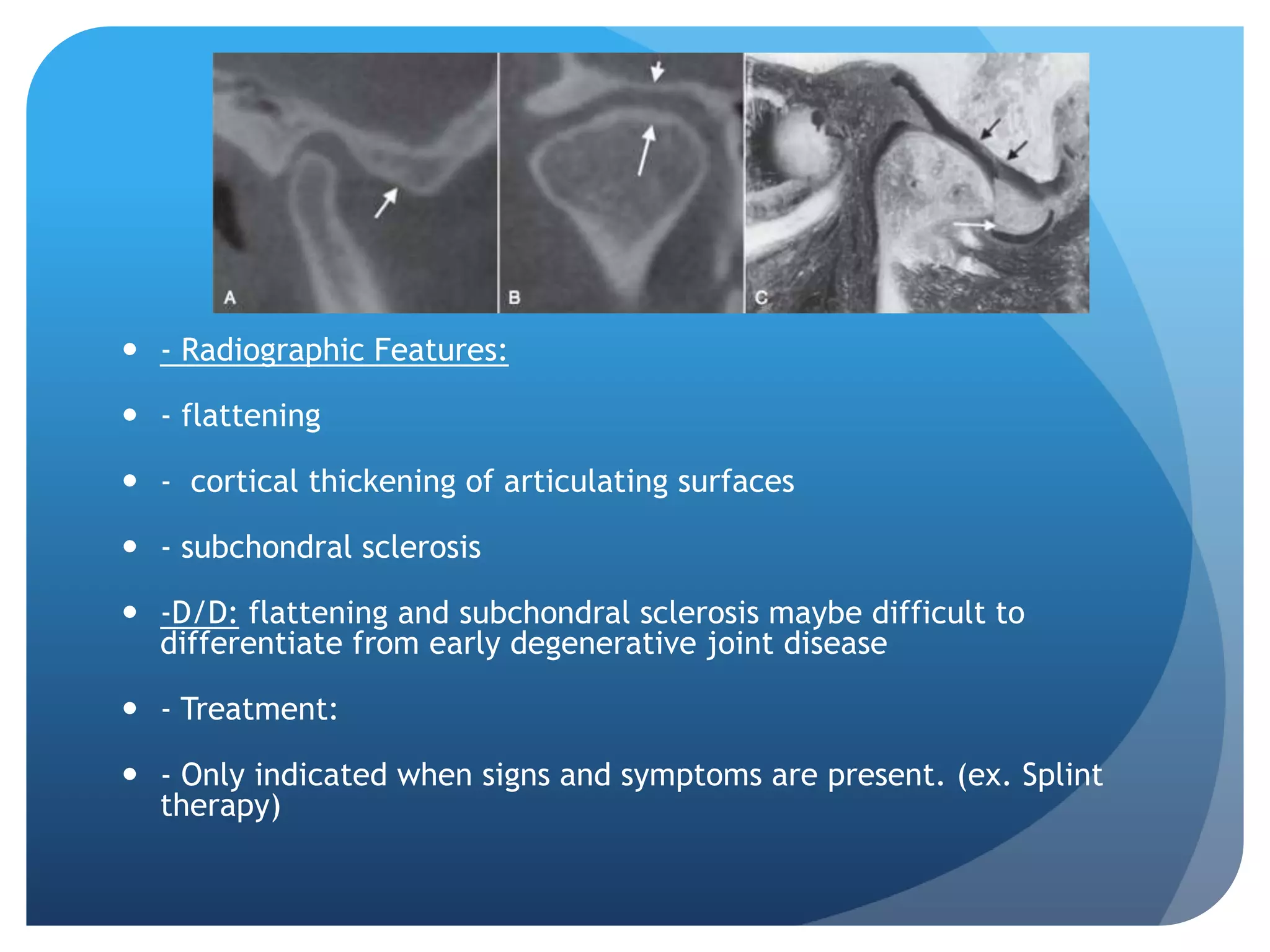  - Radiographic Features:

 - flattening

 - cortical thickening of articulating surfaces

 - subchondral sclerosis

 -D/D: flattening and subchondral sclerosis maybe difficult to
  differentiate from early degenerative joint disease

 - Treatment:

 - Only indicated when signs and symptoms are present. (ex. Splint
  therapy)
 