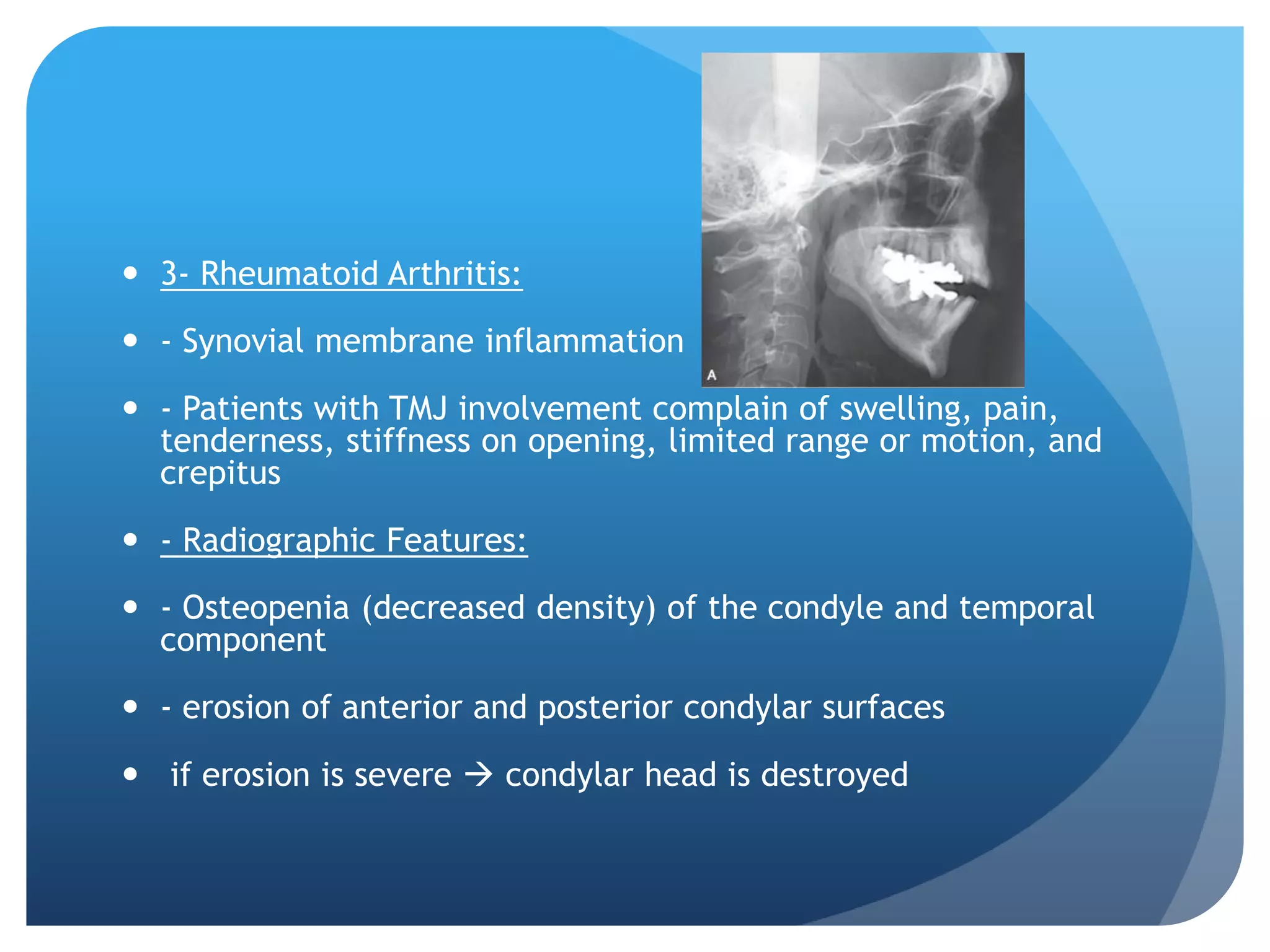  3- Rheumatoid Arthritis:

 - Synovial membrane inflammation

 - Patients with TMJ involvement complain of swelling, pain,
  tenderness, stiffness on opening, limited range or motion, and
  crepitus

 - Radiographic Features:

 - Osteopenia (decreased density) of the condyle and temporal
  component

 - erosion of anterior and posterior condylar surfaces

 if erosion is severe  condylar head is destroyed
 
