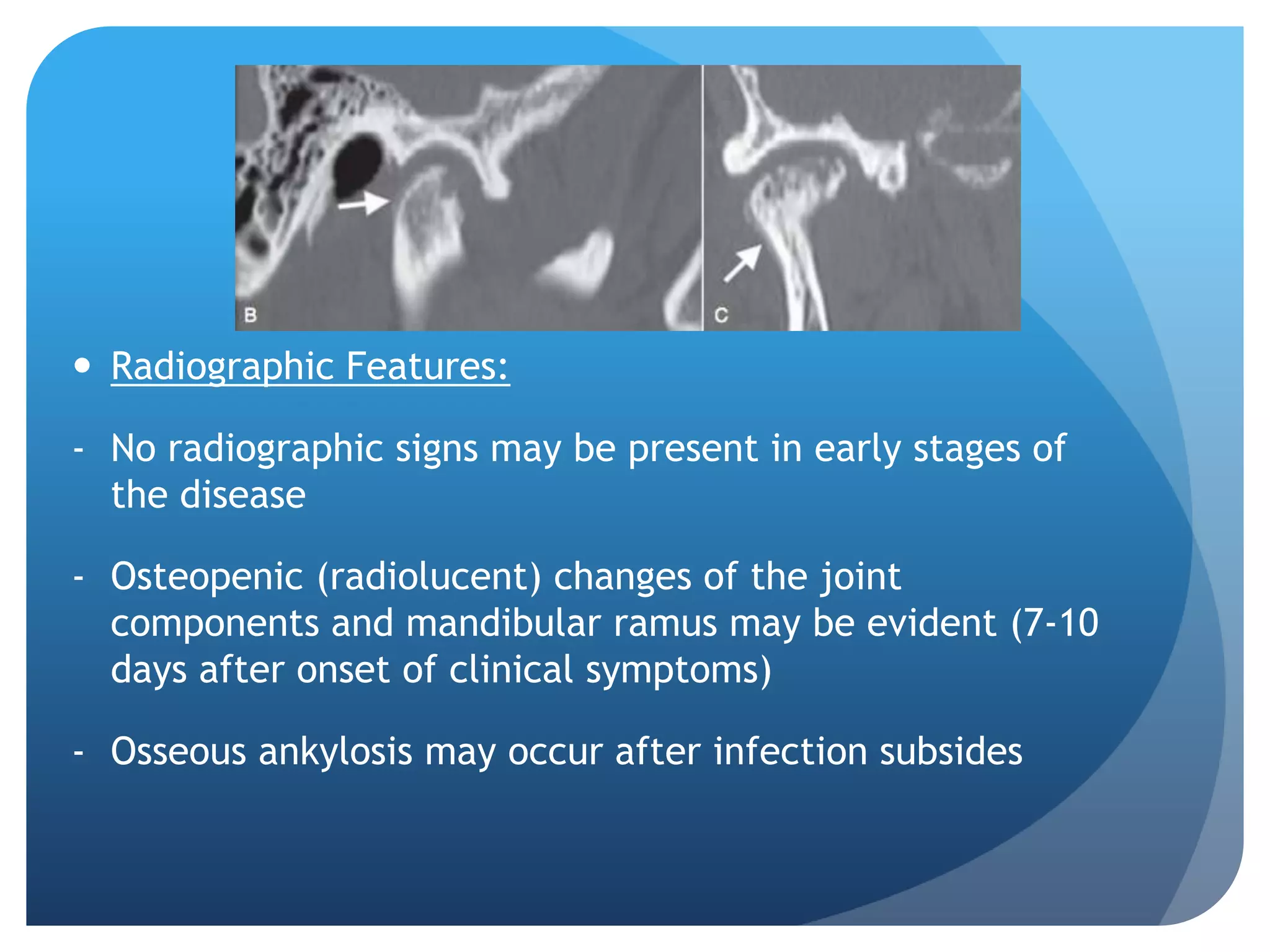  Radiographic Features:

- No radiographic signs may be present in early stages of
  the disease

- Osteopenic (radiolucent) changes of the joint
  components and mandibular ramus may be evident (7-10
  days after onset of clinical symptoms)

- Osseous ankylosis may occur after infection subsides
 