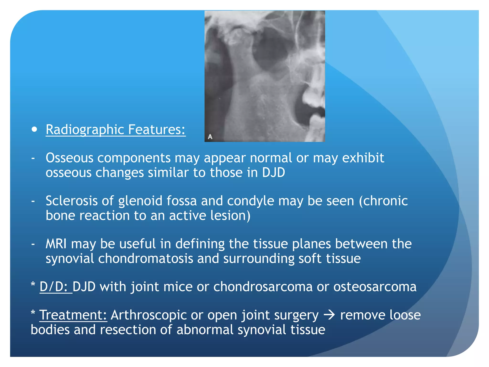  Radiographic Features:

- Osseous components may appear normal or may exhibit
  osseous changes similar to those in DJD

- Sclerosis of glenoid fossa and condyle may be seen (chronic
  bone reaction to an active lesion)

- MRI may be useful in defining the tissue planes between the
  synovial chondromatosis and surrounding soft tissue

* D/D: DJD with joint mice or chondrosarcoma or osteosarcoma

* Treatment: Arthroscopic or open joint surgery  remove loose
bodies and resection of abnormal synovial tissue
 