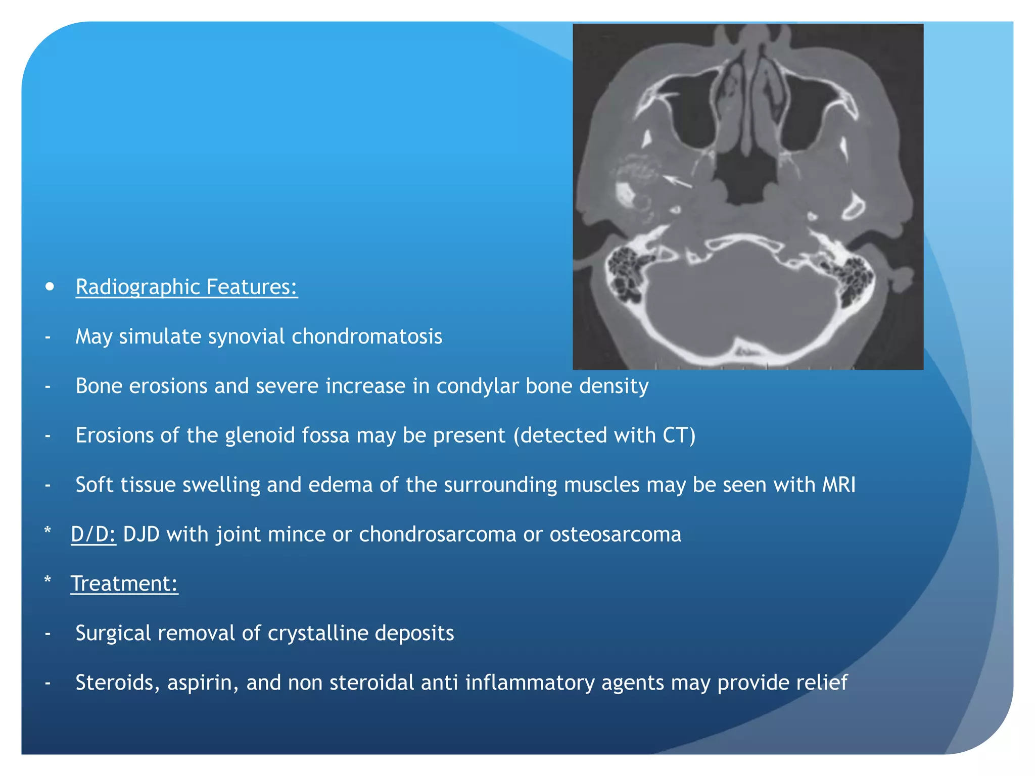  Radiographic Features:

-   May simulate synovial chondromatosis

-   Bone erosions and severe increase in condylar bone density

-   Erosions of the glenoid fossa may be present (detected with CT)

-   Soft tissue swelling and edema of the surrounding muscles may be seen with MRI

* D/D: DJD with joint mince or chondrosarcoma or osteosarcoma

* Treatment:

-   Surgical removal of crystalline deposits

-   Steroids, aspirin, and non steroidal anti inflammatory agents may provide relief
 