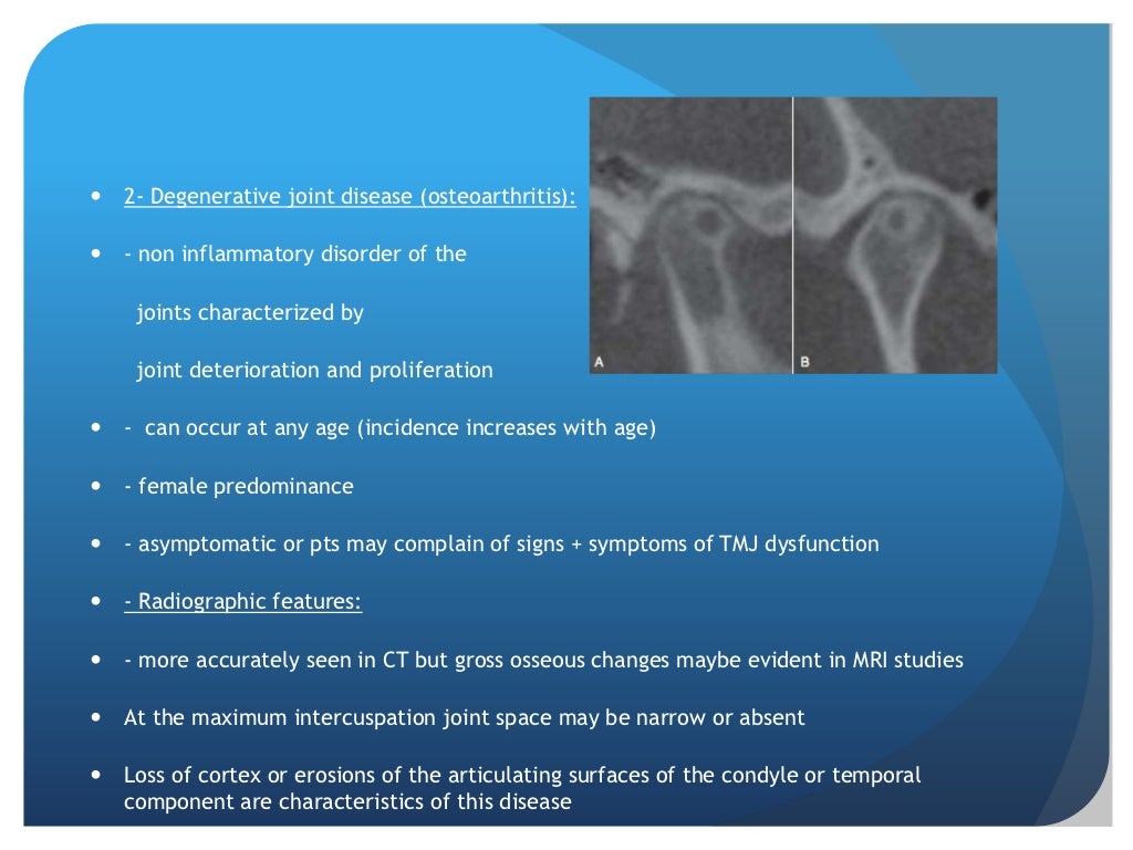 Radiographic imaging of TMJ