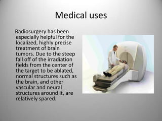 Medical uses
Radiosurgery has been
especially helpful for the
localized, highly precise
treatment of brain
tumors. Due to the steep
fall off of the irradiation
fields from the center of
the target to be ablated,
normal structures such as
the brain, and other
vascular and neural
structures around it, are
relatively spared.
 