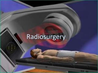 Radiosurgery
 