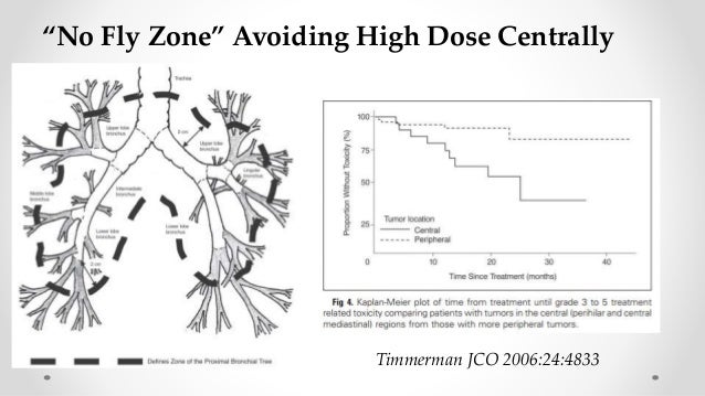 Radiosurgery for lung cancer short version