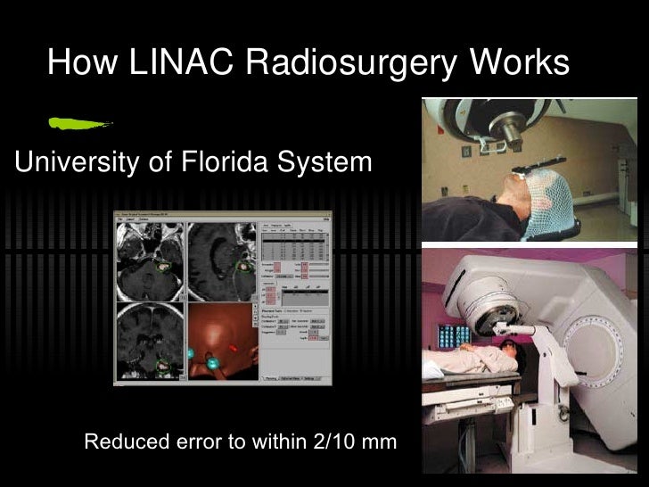 Radiosurgery Revised