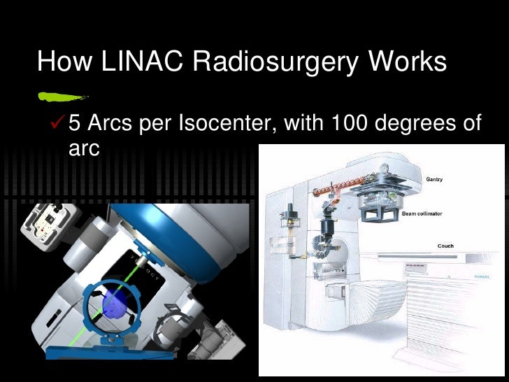 Radiosurgery Revised