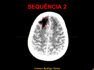 SEQUÊNCIA 2 Professor  Rodrigo Penna 
