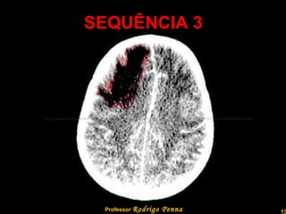 SEQUÊNCIA 3 Professor  Rodrigo Penna 