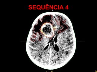 SEQUÊNCIA 4 Professor  Rodrigo Penna 
