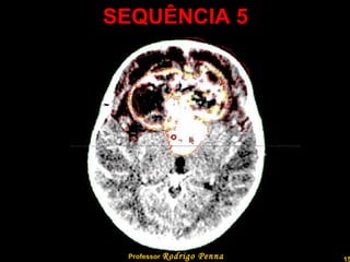 SEQUÊNCIA 5 Professor  Rodrigo Penna  www.fisicanovestibular.com.br   