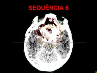 SEQUÊNCIA 6 Professor  Rodrigo Penna 