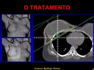 O TRATAMENTO Professor  Rodrigo Penna  www.fisicanovestibular.com.br   