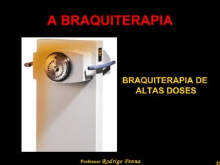 A BRAQUITERAPIA Professor  Rodrigo Penna BRAQUITERAPIA DE  ALTAS DOSES 