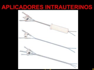 APLICADORES INTRAUTERINOS Professor  Rodrigo Penna 