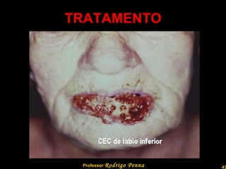 TRATAMENTO Professor  Rodrigo Penna 