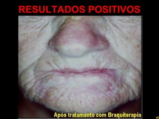 RESULTADOS POSITIVOS Professor  Rodrigo Penna 