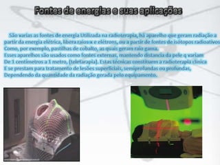 Fontes de energias e suas aplicaçõesSão varias as fontes de energia Utilizada na radioterapia, há aparelho que geram radiação apartir da energia elétrica, libera raios-x e elétrons, ou a partir de fontes de isótopos radioativosComo, por exemplo, pastilhas de cobalto, as quais geram raio gama. Esses aparelhos são usados como fontes externas, mantendo distancia da pele q variamDe 1 centímetros a 1 metro, (teletarapia). Estas técnicas constituem a radioterapia clinicaE se prestam para tratamento de lesões superficiais, semiprofundas ou profundas, Dependendo da quantidade da radiação gerada pelo equipamento.