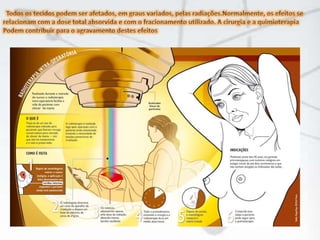 Todos os tecidos podem ser afetados, em graus variados, pelas radiações.Normalmente, os efeitos se relacionam com a dose total absorvida e com o fracionamento utilizado. A cirurgia e a quimioterapia Podem contribuir para o agravamento destes efeitos