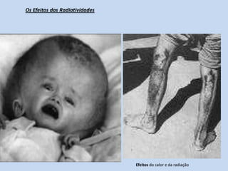 POLUIÇÃOCésio-137 Acidente Radiológico em Goiânia