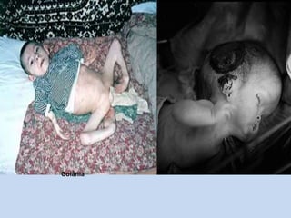 A HistóriaCom a ajuda dum amigo,consegue remover partesda peça. Os dois a levamem um carrinho de mãopara um ferro velho.Um catador de papel fica sabendo que havia umapeça de chumbo- de muito valor - nas ruínas da Santa Casa de Misericórdia.